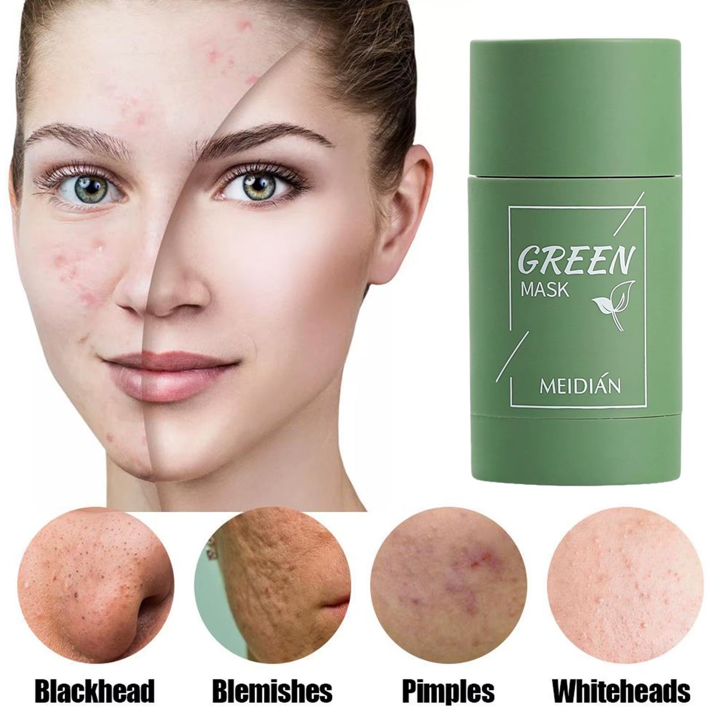 Green Tea Solid Cleansing Mask Acne Blemish Treatment Cream Blackhead Removal Natural Plant Formula Mild Skincare Solution