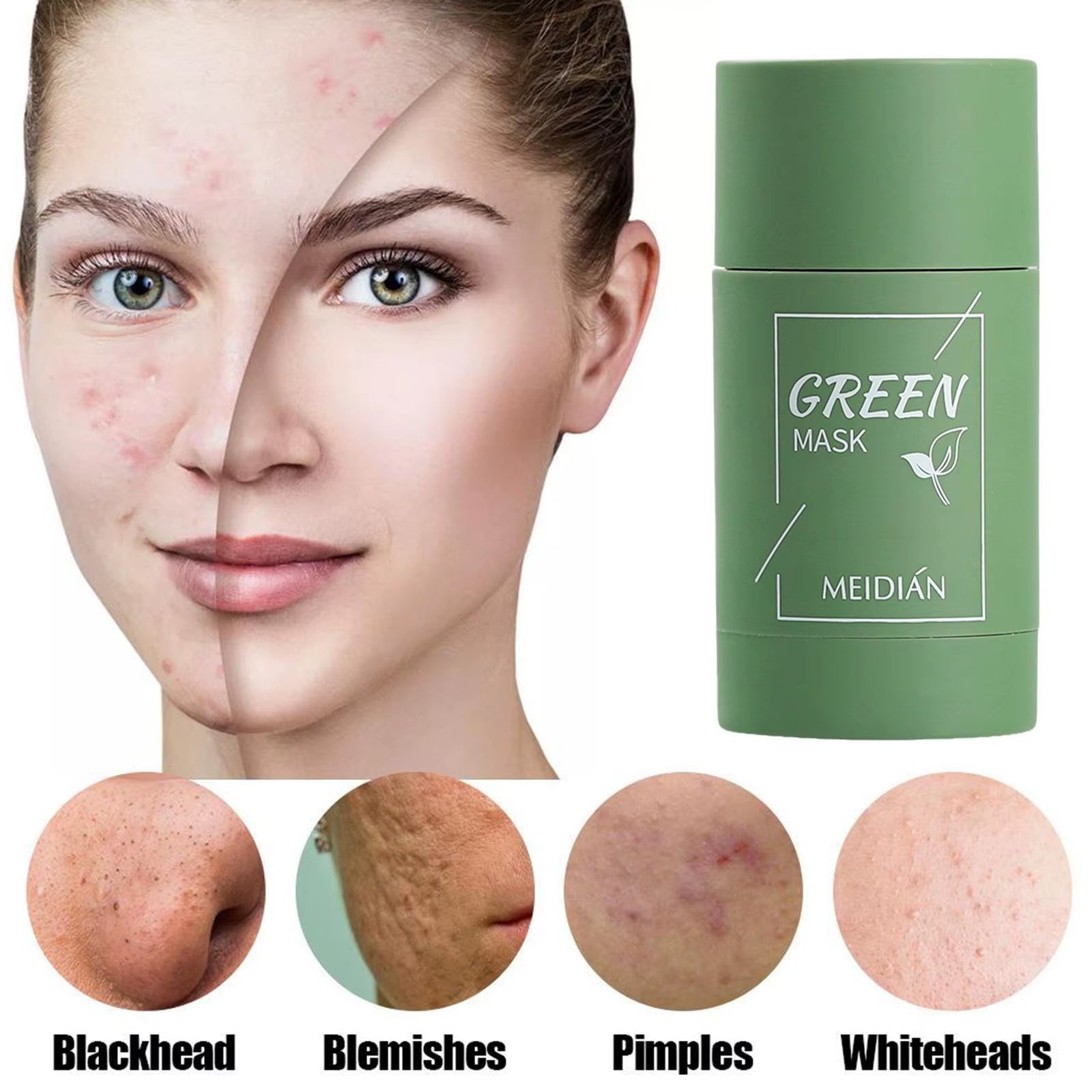 Green Tea Solid Cleansing Mask Acne Blemish Treatment Cream Blackhead Removal Natural Plant Formula Mild Skincare Solution